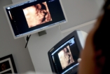 Gjorchev: „A kötelező ultrahangvizsgálat megmentheti az abortálandó magzatokat!”