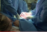 Hogyan teheti tönkre a császármetszés a nemi életet?